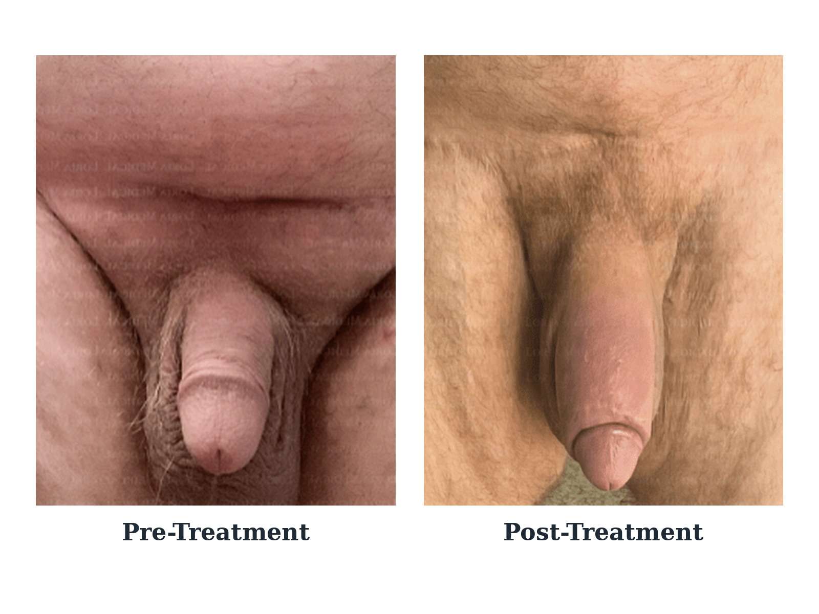 Before and after — case 19