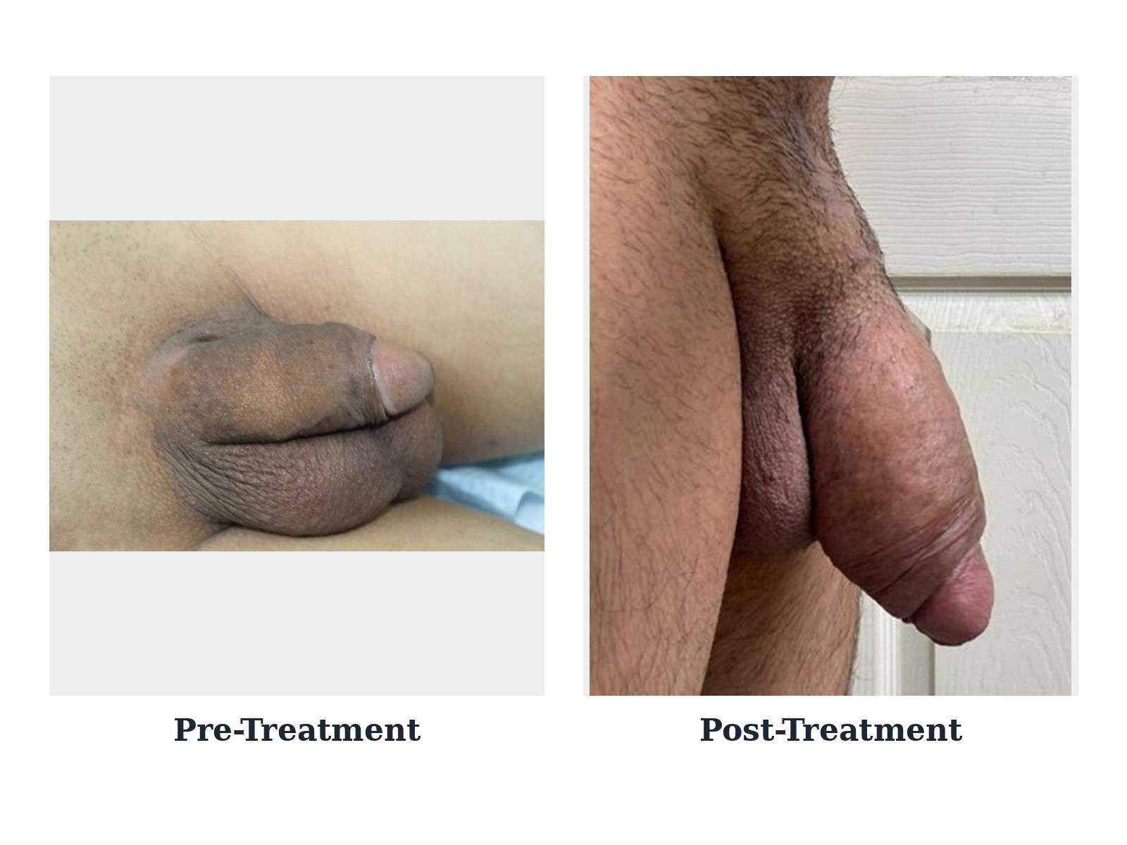 Before and after — case 46
